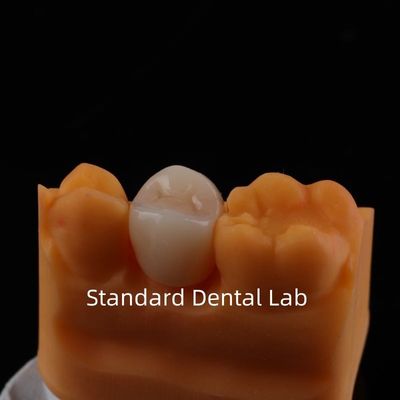 Mua Full Contour Zirconia Crown Sức mạnh và thẩm mỹ đặc biệt Không có lớp phủ sứ Crown phía sau Trung Quốc Phòng thí nghiệm nha khoa sản xuất trực tuyến