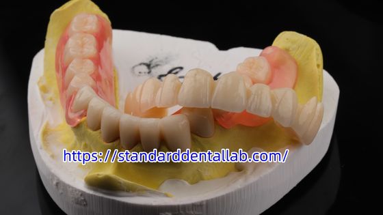Mua Phong cách thẩm mỹ cao nha khoa TCS Valplast Dentistry Phòng thí nghiệm nha khoa Valplast Clamps màu hồng sản xuất trực tuyến