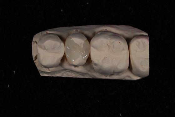 Mua Sức mạnh Emax Ceramic Veneers Crown với khả năng chống đục tuyệt vời / Tương thích sinh học sản xuất trực tuyến