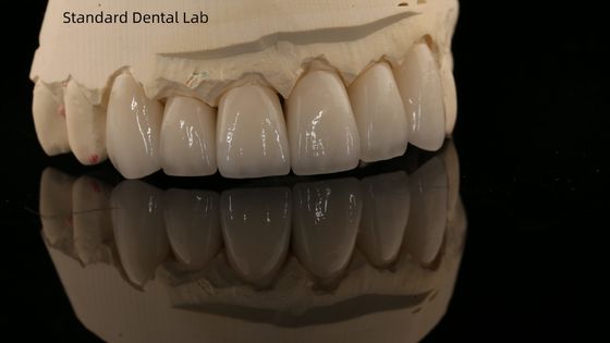 Mua Full Contour Zirconia Crown và High Aesthetic Natural Dental Bridge Bảo hành 5 năm sản xuất trực tuyến