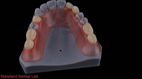 Mua Mô hình in 3D thẩm mỹ cao nha khoa TCS Valplast Dentures linh hoạt phần nha khoa phòng thí nghiệm nha khoa sản xuất trực tuyến