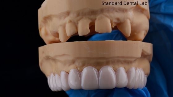 Mua Thiết bị nha khoa có tính thẩm mỹ cao Snap On Smile Thiết bị nha khoa có thể tháo rời sản xuất trực tuyến