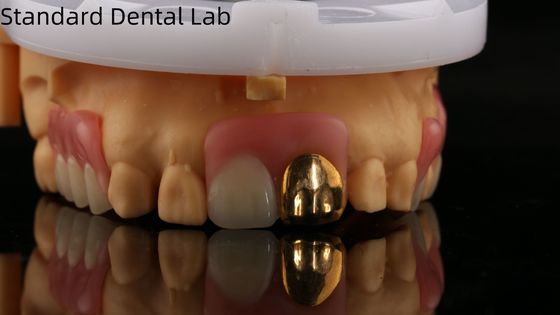 Mua Răng giả acrylic đầy đủ với răng vàng vàng / Răng giả acrylic tạm thời Ivoclar chuyên nghiệp FDA chấp thuận sản xuất trực tuyến