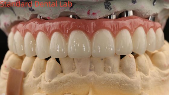 Mua Bồ sứ tất cả trên bốn Zirconia cầu thẩm mỹ cao răng cấy ghép cầu vít giữ sản xuất trực tuyến