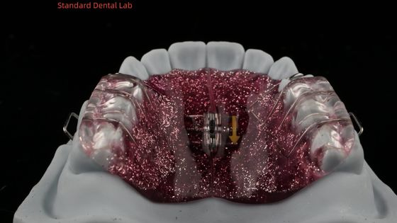 Mua Mở rộng răng và Distalization điều chỉnh mở rộng trong miệng nha sĩ chỉnh hình mở rộng miệng sản xuất trực tuyến