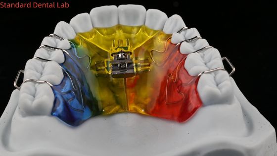 Mua Mở rộng răng và Distalization nha sĩ chỉnh hình miệng mở rộng Trung Quốc Phòng thí nghiệm nha khoa sản xuất trực tuyến