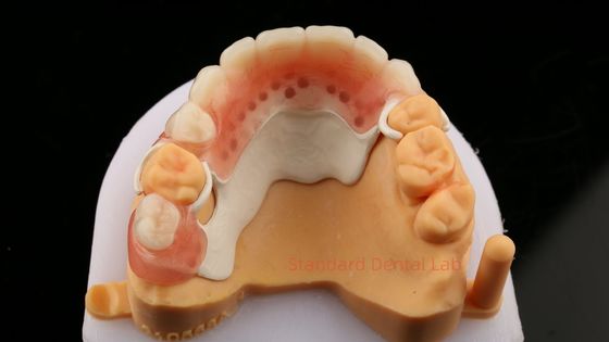 Mua Peek Thiết kế khung một phần ISO CE và FDA Phòng thí nghiệm nha khoa Acrylic khung răng giả một phần sản xuất trực tuyến