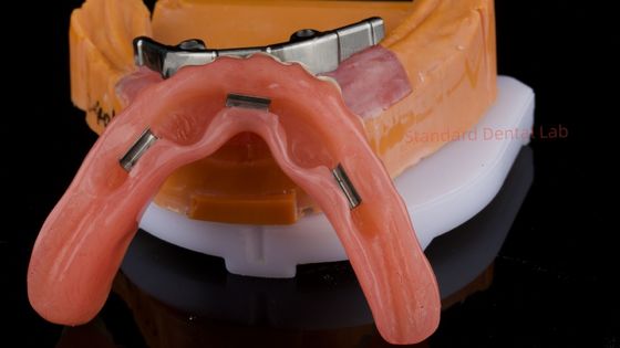 Mua Ivoclar Digital Dental Implant Denture Bar with Attachments Full Acrylic Denture Titanium Denture Supported Dentures sản xuất trực tuyến