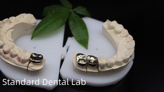 Mua Chuyên nghiệp ISO và FDA chấp thuận vàng vàng vương miện cho phòng thí nghiệm nha khoa vận chuyển UPS hoặc Fedex thời gian sản xuất 2 ngày sản xuất trực tuyến
