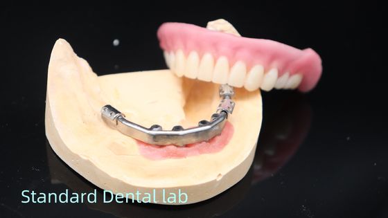 Mua Mùi vịt được hỗ trợ bằng cấy ghép răng giả Mùi vịt chính xác trên cấy ghép sản xuất trực tuyến