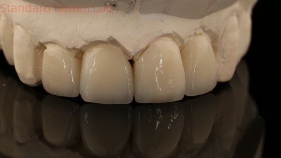 Mua Strong lớp Zirconia vương miện và cầu trong thẩm mỹ tốt Zirconia lớp Trung Quốc phòng thí nghiệm nha khoa sản xuất trực tuyến