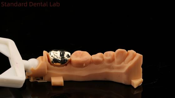 Mua Cao Nobel vàng vàng vương miện răng chuyên nghiệp Ni Be miễn phí ISO và FDA phê duyệt Trung Quốc phòng thí nghiệm nha khoa sản xuất trực tuyến