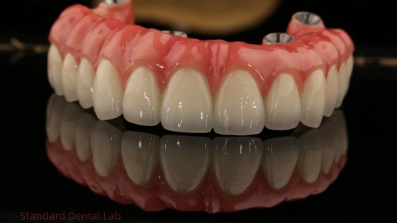 Mua Full Arch Zirconia Implants Bridge Zirconia Crown Vita Shade tùy chỉnh tất cả trên bốn / sáu cấy ghép răng sản xuất trực tuyến