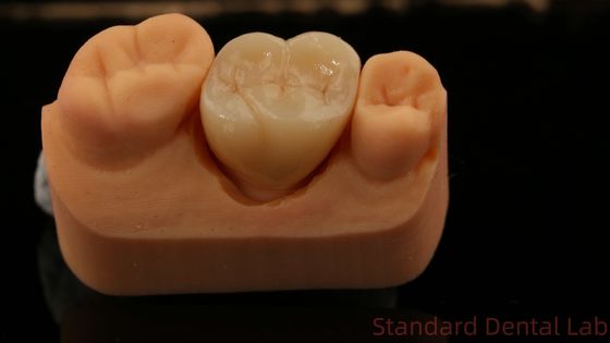 Mua Sơn và trung tâm đầy đủ Zirconia Crown, Trung Quốc phòng thí nghiệm nha khoa nhanh chóng giao hàng sản xuất trực tuyến