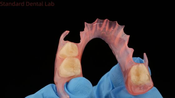 Mua Mô hình in 3D nha khoa TCS Valplast Flexible Partial Dentures Màu hồng / tối sản xuất trực tuyến