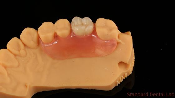 Mua Răng TCS Valplast Dental Valplast linh hoạt phần răng giả Nesbit Valplast Finish Trung Quốc Phòng thí nghiệm nha khoa Valplast Clamp sản xuất trực tuyến