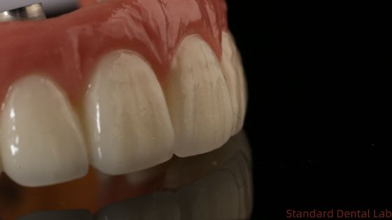 Mua Các chuyên gia Zirconia răng cấy ghép Vương miện Titanium CAD CAM Zirconia Vương miện Trung Quốc Phòng thí nghiệm nha khoa sản xuất trực tuyến