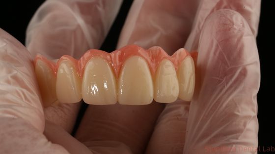 Mua Gốm sứ tất cả trên bốn Zirconia Bridge High Esthetics Dental Implant Bridge sản xuất trực tuyến