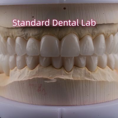 Phòng thí nghiệm nha khoa Full Arch Zirconia Porcelain Crown PFZ Crown ISO FDA CE