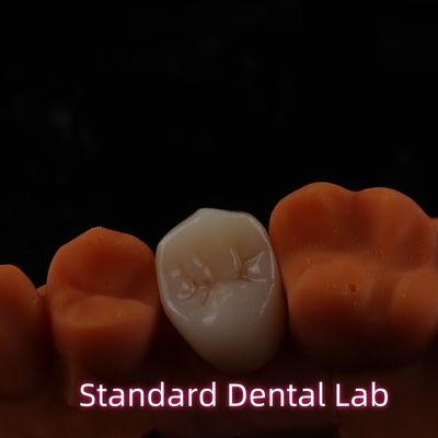 Có thẩm mỹ cao BruxZir Full Contour Zirconia Crown PFZ Bridge