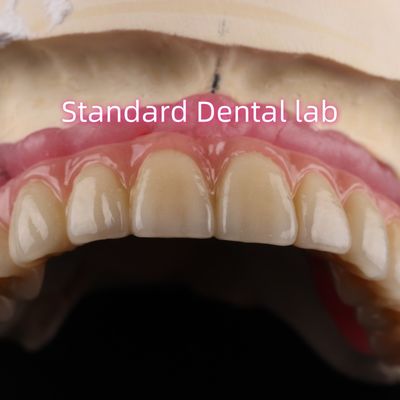 Xăng nhanh và tiết kiệm thời gian sản phẩm cấy ghép nha khoa Zirconia vương miện cầu