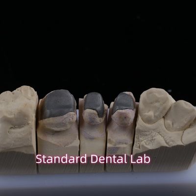 Kim loại đúc Post Core Crown Cocr chính xác giữ đầy đủ Zirconia Bruxier