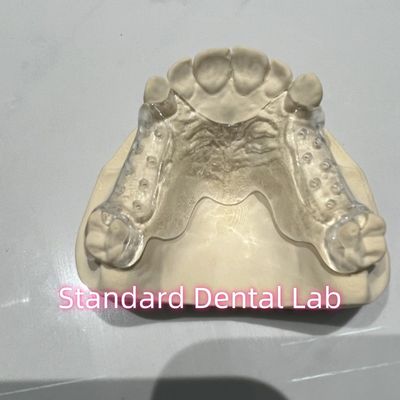Khởi bỏ khung đúc rõ ràng một phần dễ dàng để làm sạch và tháo