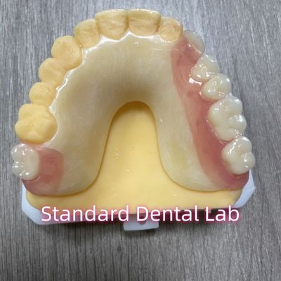 OEM Đánh răng đúc có thể tháo rời Mái răng Acrylic Phần răng giả với khóa