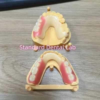 Hình sắc răng thẩm mỹ khung axet răng màu cắm Ivoclar thiết lập