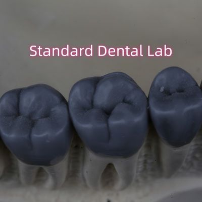 Phòng thí nghiệm nha khoa kỹ thuật số chuyên nghiệp Wax Up 3shape FDA chấp thuận