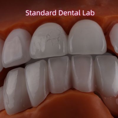 Lithium Dicilicate lớp Ivoclar Emax Zirconia Laminate Veneers Tấm xuyên OEM ODM