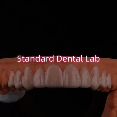 Mùi răng trên nụ cười veneers cho răng đổi màu / khoảng trống