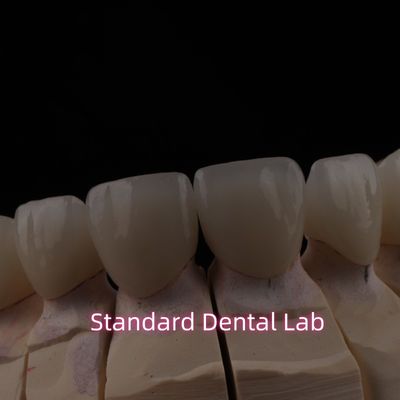 PFZ Dental Layered Ceramic Zirconia Bridge với Incisal Translucent