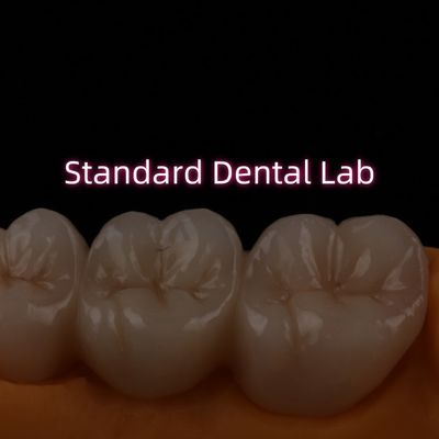 cao xuyên suốt PFZ lớp Zirconia cầu sứ gốm hậu