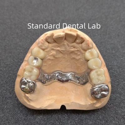 Mẫu răng chính xác có thể tháo rời
