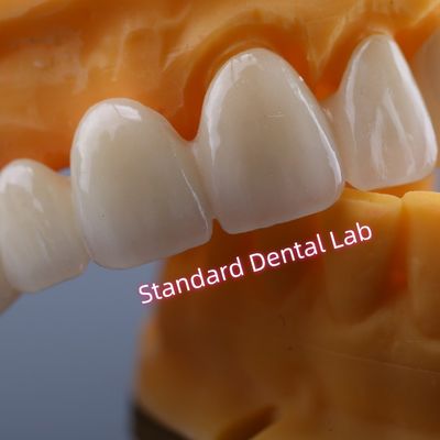 CAD CAM Mill Zirconia Crown Bridge Tương thích sinh học cao