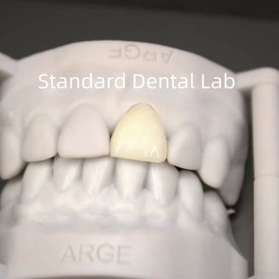 CAD CAM kỹ thuật số Vương miện phòng thí nghiệm nha khoa Trò xuyên suốt Lớp vương miện Zirconia