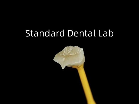 Đồ sứ nha khoa Inlay Onlay Zirconia Emax High Esthetics
