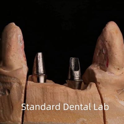 Hồ sứ nha khoa Zirconia Implant Crown chuyên nghiệp thẩm mỹ cao