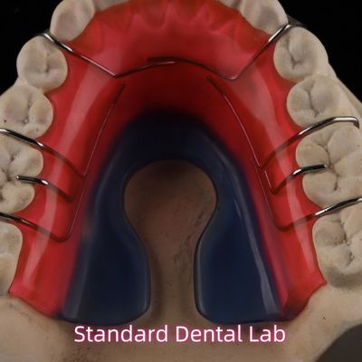 Thiết bị chỉnh nha răng có thể tháo rời Hawley Retainer
