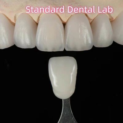 High Aesthetic Tự nhiên tùy chỉnh Aidite Zirconia Dental Bridge