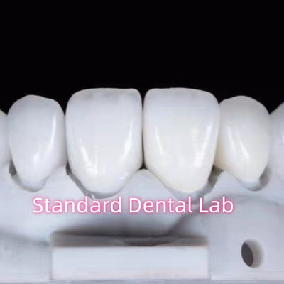 Sự phục hồi trông tự nhiên Aidite răng Zirconia Vương miện răng