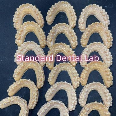 Các thiết bị giữ răng không nhìn rõ