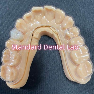 Professional Orthodontic Retainer Clear Essix Retainers với răng nhựa Acrylic ổn định