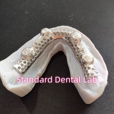 Phân hình kim loại Cobalt Chrom đúc răng giả một phần với khung kim loại