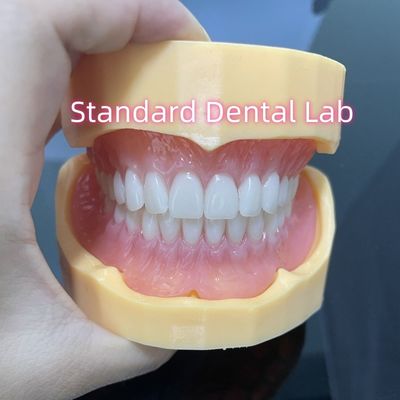 Mùi cao thẩm mỹ đầy đủ hàm răng Acrylic trên và dưới