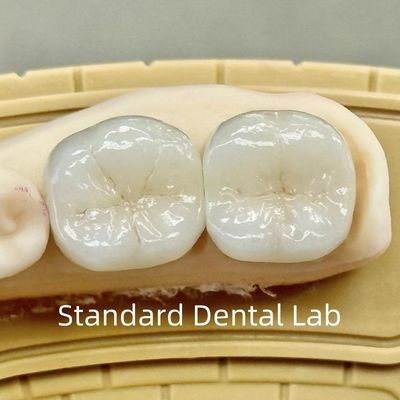 Vương miện phòng thí nghiệm nha khoa xuyên suốt Full Contour Zirconia với sức mạnh vượt trội