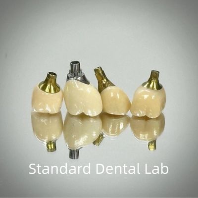 Chuyên nghiệp Zirconia vít giữ cấy ghép vương miện Titanium CAD CAM