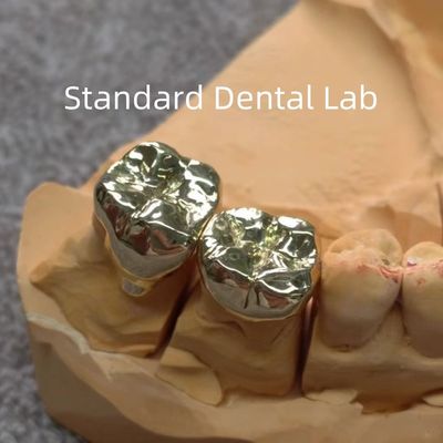 Cao Nobel vàng răng vàng vương miện chuyên nghiệp Ni Be miễn phí ISO chấp thuận