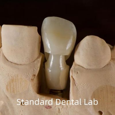 Cấy ghép răng Tibase Zirconia Abutment Titanium Độ chính xác tùy chỉnh